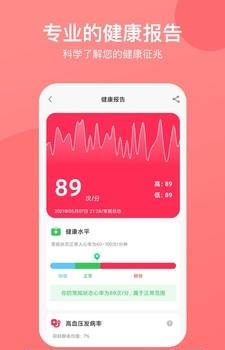 心率心电图