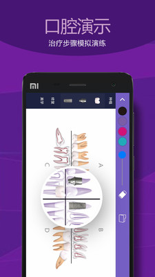 天齿月牙  v1.3.5图2