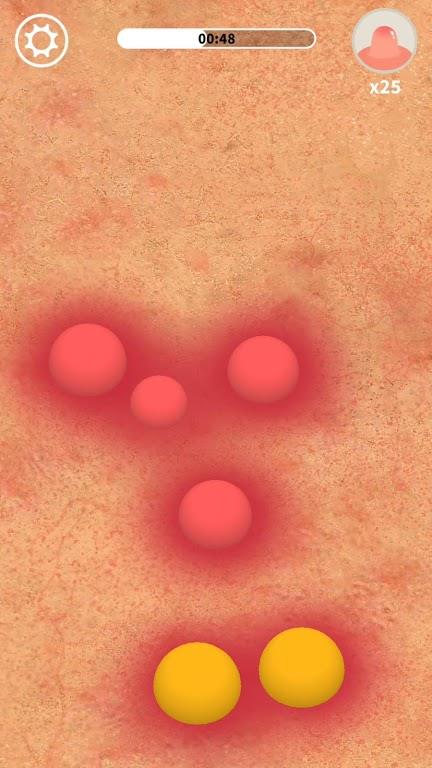 Acne  v1.0.1图3